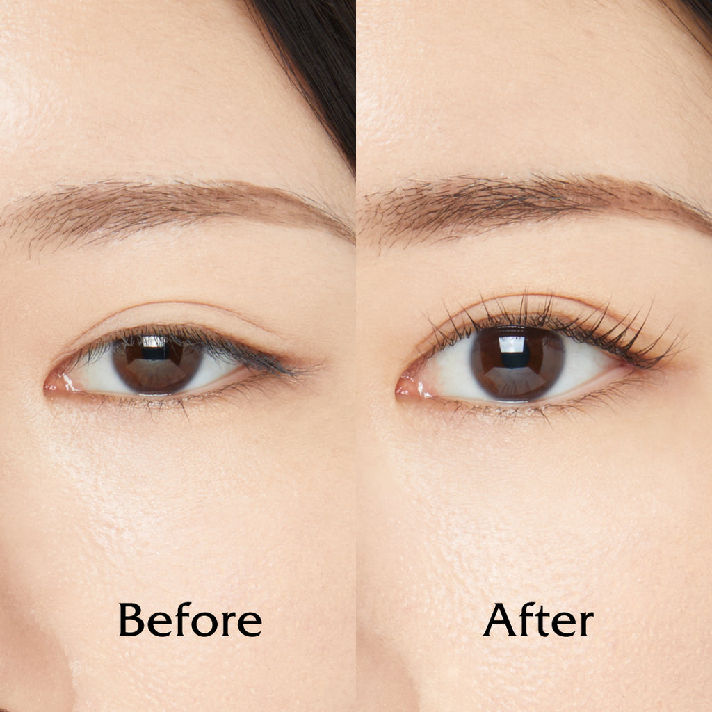 女性の目のビフォー・アフター画像